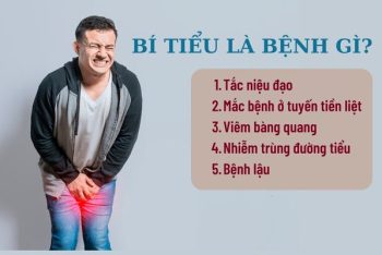 Bí tiểu là bị bệnh gì và cách điều trị ra sao?