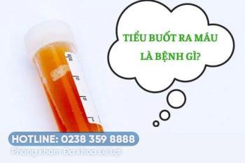 Tiểu buốt ra máu, tiểu buốt là bệnh gì?