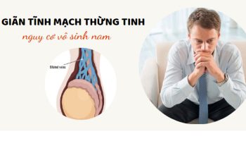 Giãn tĩnh mạch thừng tinh có gây vô sinh không?