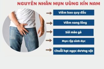 Mụn vùng kín nam nguyên nhân và cách điều trị