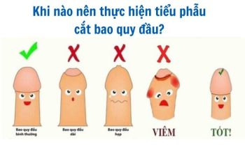 Các bệnh bao quy đầu thường gặp