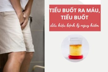 Tiểu buốt ra máu, tiểu buốt là bệnh gì?