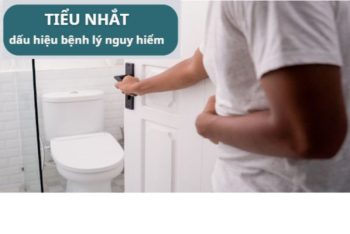 Tiểu nhắt nguyên nhân dấu hiệu và cách điều trị