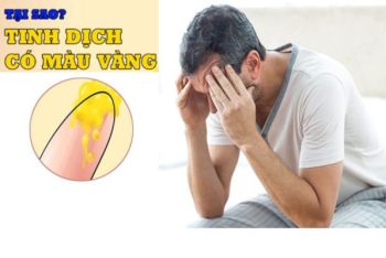 Tinh dịch màu vàng là bệnh gì nguy hiểm không?