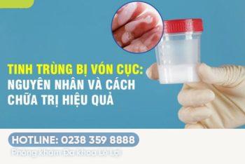 Tinh dịch vón cục là dấu hiệu của bệnh gì?