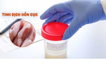 Tinh dịch vón cục là dấu hiệu của bệnh gì?