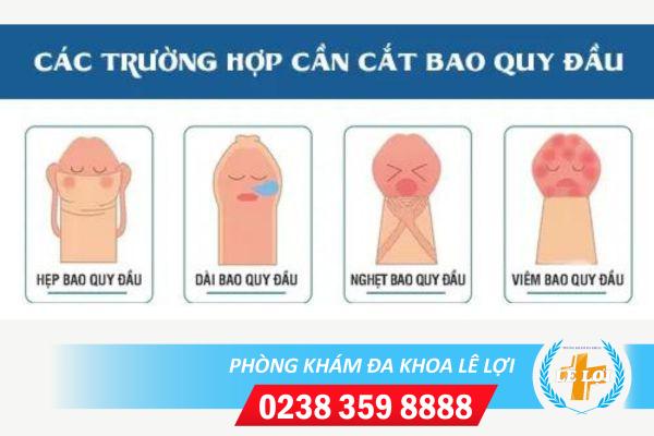 tu-van-cat-bao-quy-dau-mien-phi-nhanh-chong-o-vinh-1