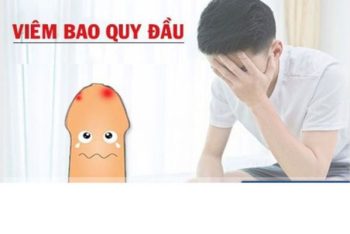 Viêm bao quy đầu và cách xử lý an toàn hiệu quả