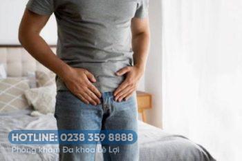 Tinh hoàn không đều là bệnh gì?