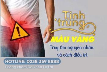 Tinh dịch màu vàng là bệnh gì nguy hiểm không?