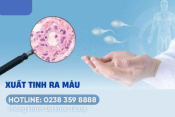 Tinh dịch có máu dấu hiệu cảnh báo bệnh lý nguy hiểm