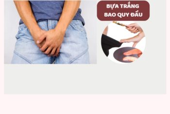 Bựa trắng bao quy đầu là bệnh gì?