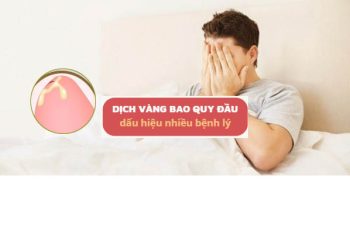 Dịch vàng bao quy đầu là bị bệnh gì?