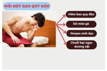 Nổi hột bao quy đầu cảnh báo bệnh gì?