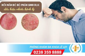 Nổi mẩn đỏ bộ phận sinh dục là bị bệnh gì?