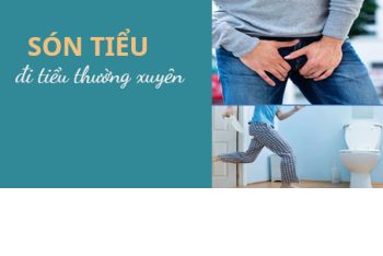 Són tiểu nguyên nhân triệu chứng và cách chữa trị