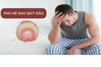 Tại sao bị phù nề bao quy đầu và cách điều trị