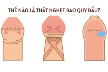 Dấu hiệu thắt nghẹt bao quy đầu và cách điều trị