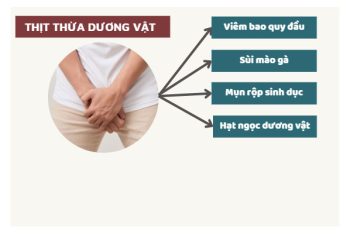 Thịt thừa dương vật là bị bệnh gì nguy hiểm không?