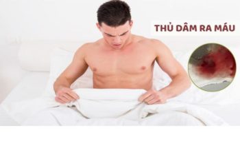 Thủ dâm ra máu nguy hiểm không?