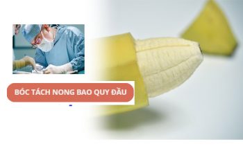 Bóc, tách, nong bao quy đầu là gì?