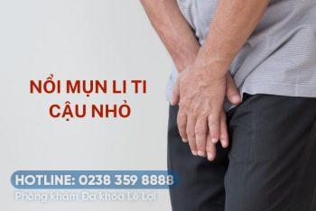 Mụn li ti cậu nhỏ nguyên nhân và cách điều trị