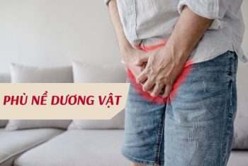 Phù nề dương vật phải làm sao?