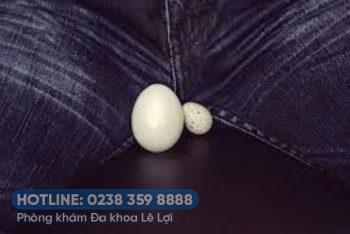 Cách điều trị tinh hoàn teo một bên hiệu quả