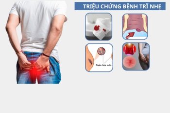 Bị trĩ nhẹ có tự khỏi không?