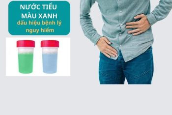 Nước tiểu màu xanh có phải mắc bệnh nguy hiểm?