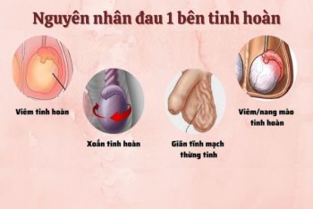 Đau một bên tinh hoàn: cẩn thận với các triệu chứng nguy hiểm này!