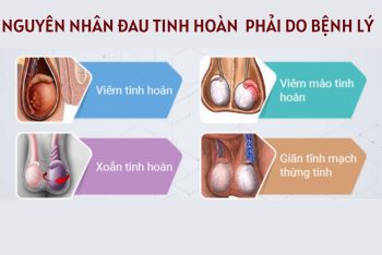 Đau nhức tinh hoàn bên phải cảnh báo bệnh gì?