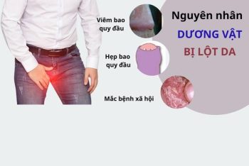 Dương vật bị lột da là bệnh gì?