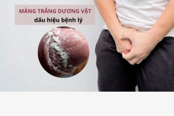 Mảng trắng dương vật là bệnh gì?