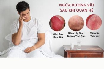 Ngứa dương vật sau khi quan hệ do đâu?