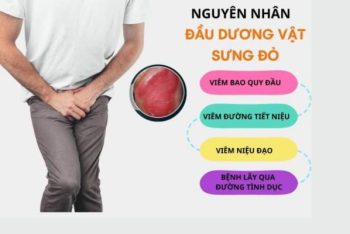 Nguyên nhân đầu dương vật sưng đỏ và cách điều trị