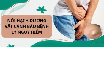 Dương vật nổi hạch có phải đang mắc bệnh nguy hiểm?