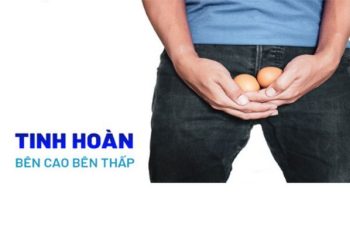 Tinh hoàn bên cao bên thấp nguy hiểm không?