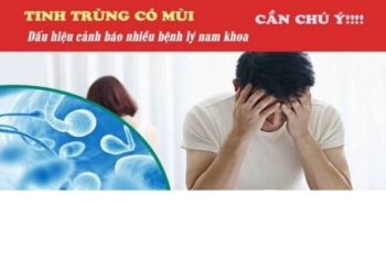 Tinh trùng có mùi hôi là bị gì?