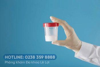 Tinh trùng màu trắng đục có bình thường không?