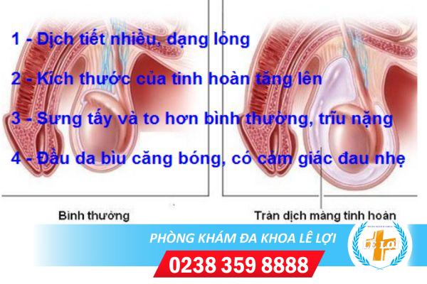 tran-dich-mao-tinh-hoan-nguyen-nhan-dau-hieu-va-cach-chua-1