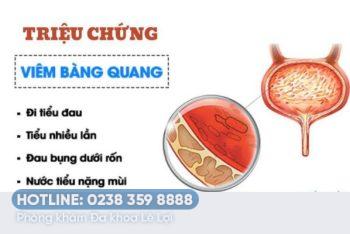 Cách chữa viêm bàng quang nam hiệu quả