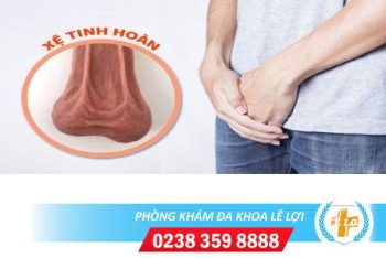 Xệ tinh hoàn điều trị như thế nào?