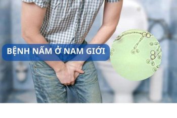 Hình ảnh bệnh nấm ở nam giới