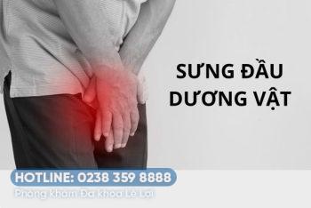 Đầu dương vật bị sưng nguy hiểm không nguyên nhân