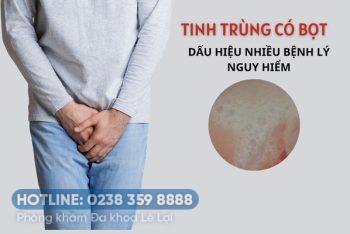 Tinh trùng có bọt là bị bệnh gì điều trị thế nào?