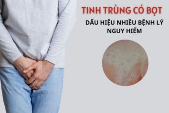 Tinh trùng có bọt là bị bệnh gì điều trị thế nào?