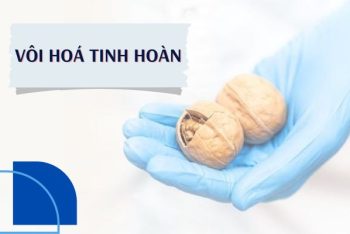 Nguyên nhân gây vôi hoá tinh hoàn và cách trị