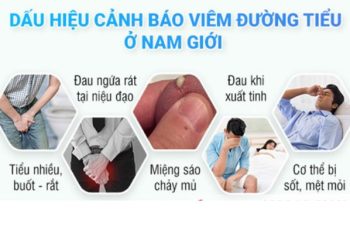 Đau đường ống tiểu là dấu hiệu bệnh gì?