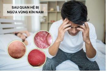 Sau khi quan hệ bị ngứa vùng kín nam nguyên nhân và cách điều trị